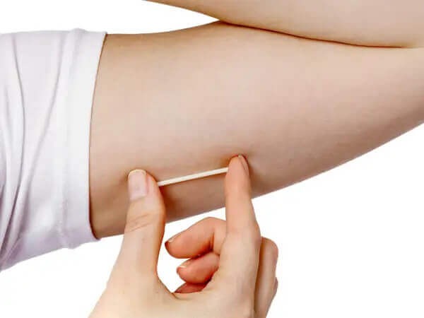 Implanon - Implante Contraceptivo colocado pela Dra. Francisca Lopes em Teresina